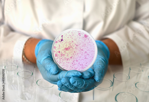 a girl in a medical gown and gloves holds a photo gonorrhea from a microscope in a round frame photo