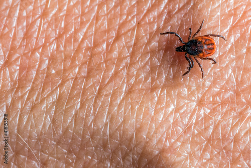 A predatory parasitic tick on a human skin. Selective focus. . photo