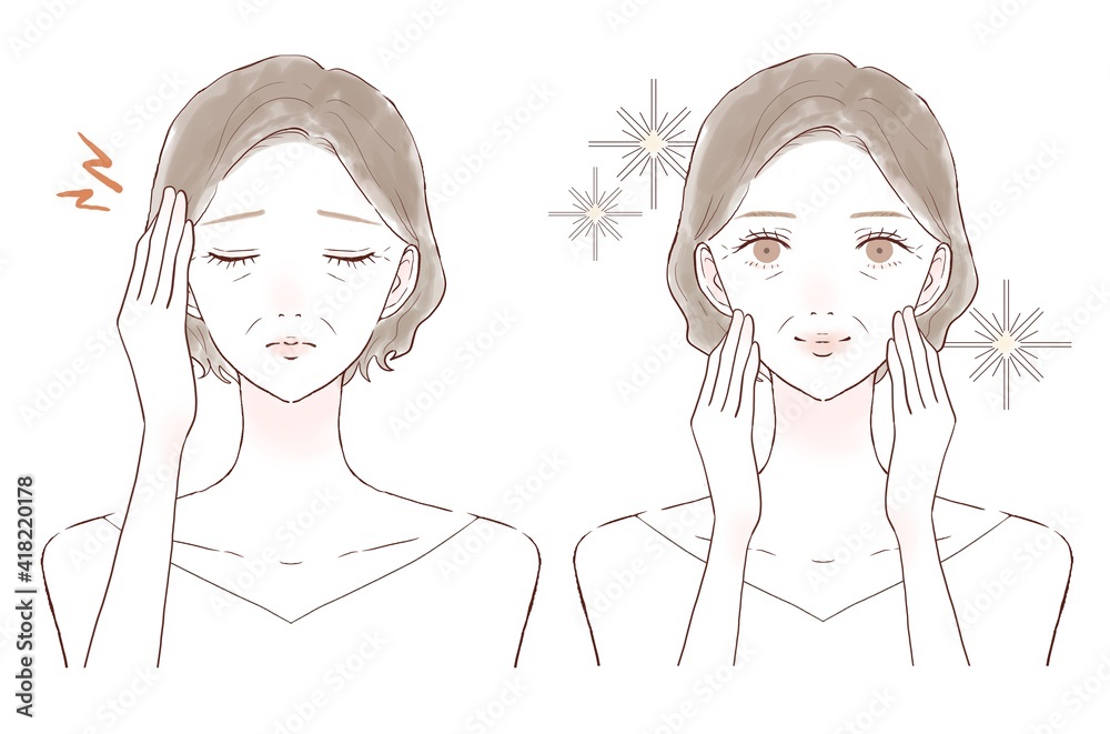 中年　女性　頭痛　ビフォーアフター