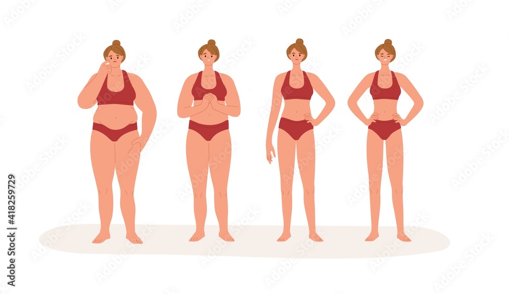Stages of transformation process from fat obese body with belly to slim and  thin figure. Weight loss concept. Colored flat cartoon vector illustration  of woman in lingerie isolated on white background Stock