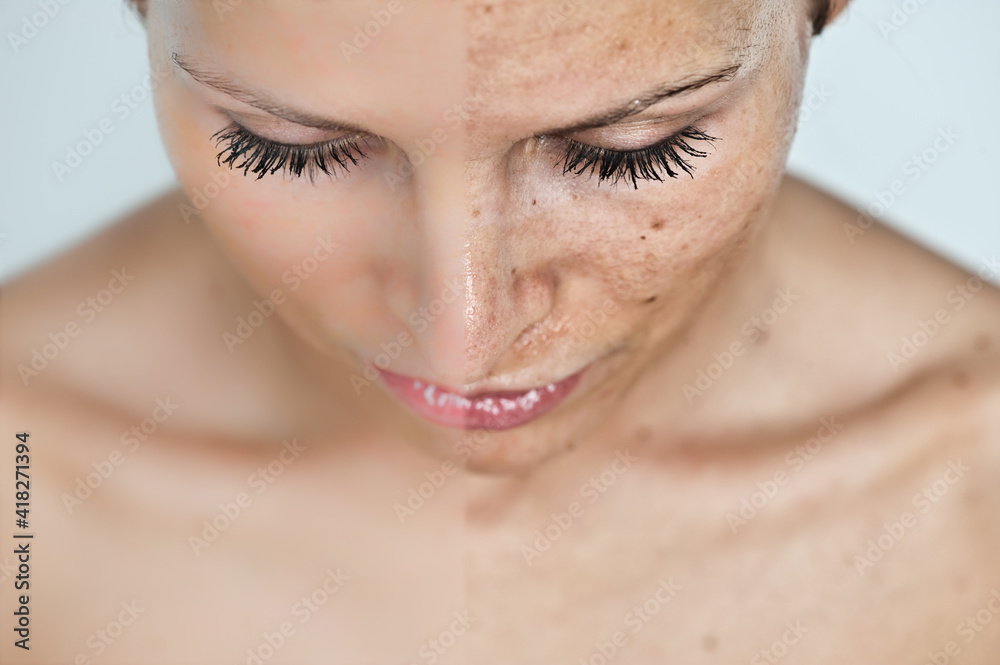 face skin before and after face skin before and after