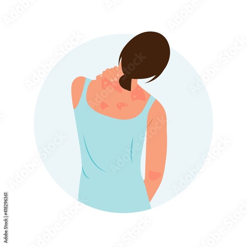 The woman is scratching her back. Allergic itching, skin inflammation, redness and irritation. Atopic dermatitis, eczema, psoriasis, dry skin. Skin problems Concept, isolated, vector.