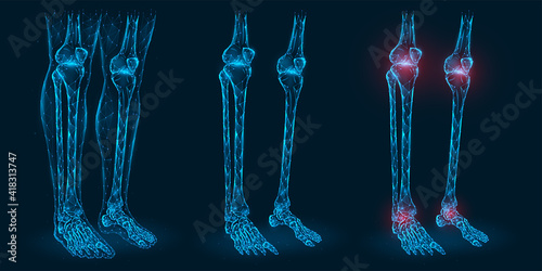Pain, injury or inflammation in the knees and ankles polygonal vector illustration. Low poly model of diseased knee and ankle joints.