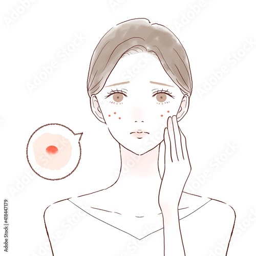 スキンケア　女性　ニキビ