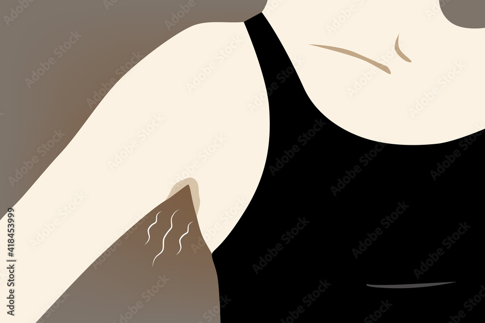 smelly armpits is caused by bacteria breaking down sweat and is largely