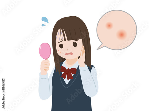 ニキビに悩む　学生　女子生徒　女の子　美少女　吹き出物　上半身　イラスト素材