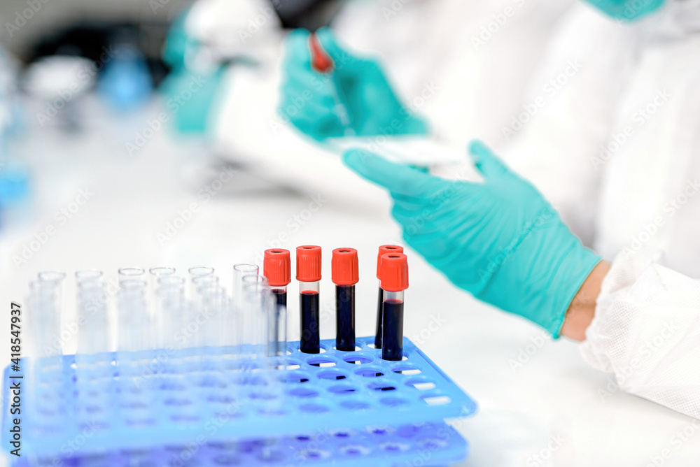 A blood test tube is placed next to the scientist wearing the ppe kit.. A blood test tube is placed next to the scientist wearing the ppe kit..