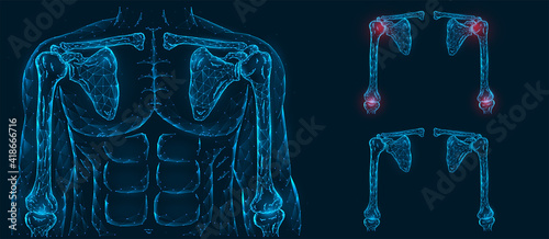 Pain, injury and inflammation of the shoulder and elbow joints front view polygonal illustration on a blue background. Healthy and sore joints.