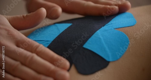 Close up shot: physiotherapist sticks kinesio tapes to the back of patient, kinesiology taping, kinesiological therapy, athlete's recovery, 4k 60p Prores HQ 10 bit photo