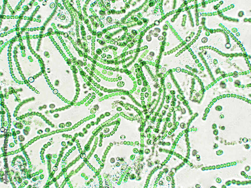Nostoc sp. algae under microscopic view Nostoc sp. algae under microscopic view