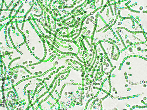 Nostoc sp. algae under microscopic view photo