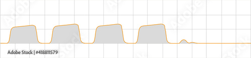 Arterial pulse Capnography Waveform monitoring during an apnea. waveform photo