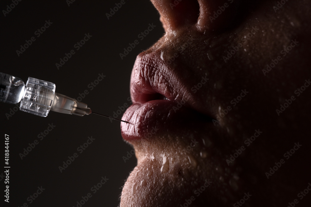 Obraz premium Hyaluronic acid injection. Procedure of lips augmentation. Syringe female mouth. Cosmetology Treatment.