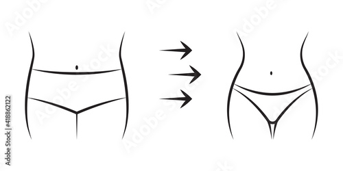 Fat and slim female body icons. Weight loss concept. Woman's waist, belly before and after diet, exercises, gym or workout. Girls figure transformation. Vector illustration.