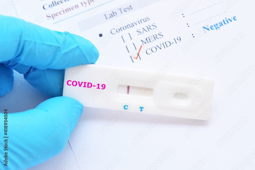 Negative test result by using rapid test device for COVID-19 virus