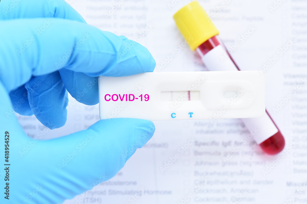 Positive test result by using rapid test device for COVID-19 virus Positive test result by using rapid test device for COVID-19 virus