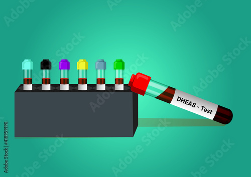 Blood sample for DHEAS (dehydroepiandrosterone sulfate) hormone test. A medical testing concept with tube vector in the laboratory background. photo
