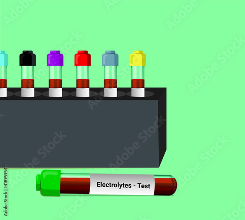 Blood sample for electrolytes test. Blood collection tube with Lithium heparin as an anticoagulant. A medical testing concept with tube vector in the laboratory background.