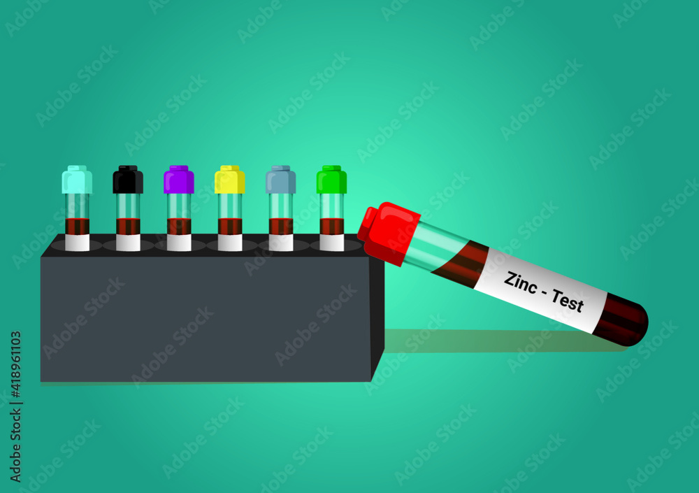 Blood sample for Zinc (Zn) test. A medical testing concept with tube