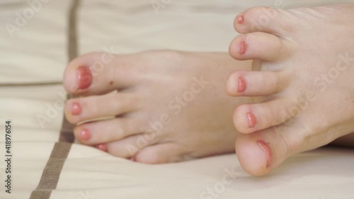 Close up of woman feet with pink pedicure. Cuticles need treatment. Lazy on pastel bed linen. Small mole on lady feet