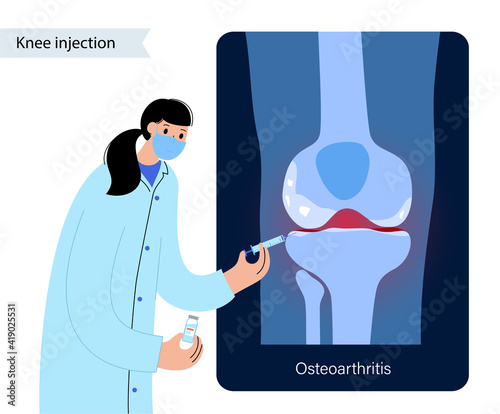 Knee Injection treatment