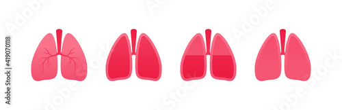 Human organ collection. Vector flat modern anatomical icon color illustration set. Healthy and ill red lung isolated on white background. Health care medical sign. Design element for pulmonology.