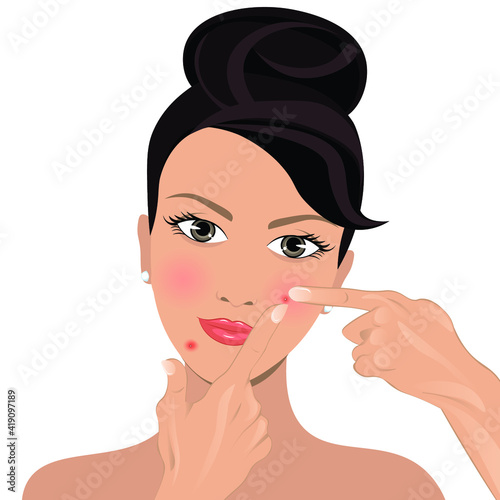 The girl herself removes a pimple on her face. Vector illustration