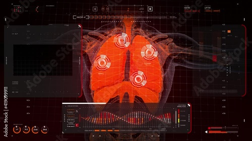 Analysis of Human Anatomy Scan on Futuristic Touch Screen Interface showing blood circulation, organs. Digital displays with an x-ray scan of lungs,graphs of DNA analysis. HUD interface.