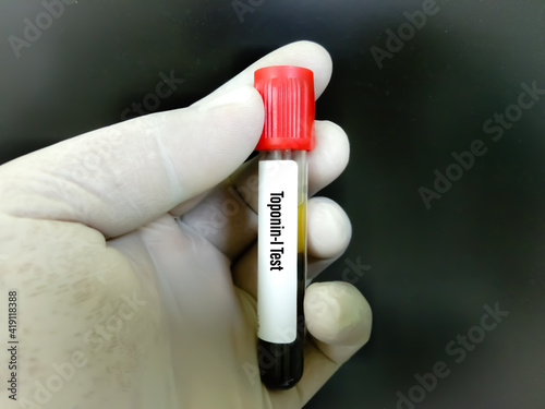 Blood sample for Troponin-I, T test, diagnosis for cardiovascular disease. myocardial infarction, heart injury photo