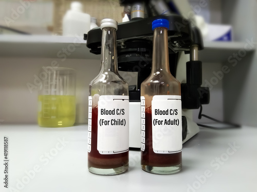 Culture bottles containing liquid media and human blood. For adult and child patient at laboratory bacterial growth. Hemoculture incubator. Blood culture bottle. Selective focus. photo