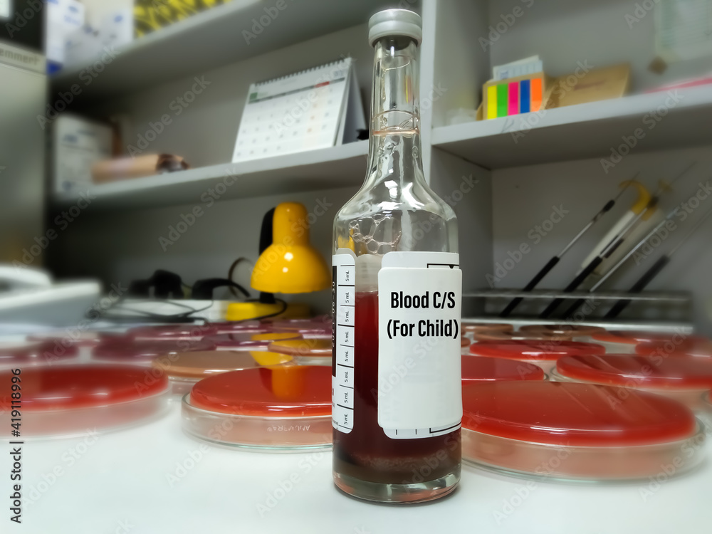 Culture bottles containing liquid media and human blood. For adult and