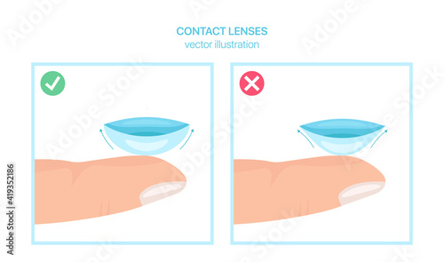 Vector guide how to put on contact eye lenses correctly. Right or wrong lens position. Vector illustration. 