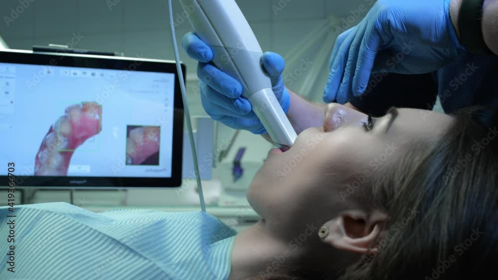 Doctor scans the patient's teeth in the clinic. The dentist holds in his hand a manual 3D scanner for the jaw and mouth. Dental health. Creates a 3D model of teeth and gums on a medical monitor.