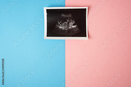Image of baby in mother womb during ultrasound on pink and blue background. Boy or girl expecting concept.