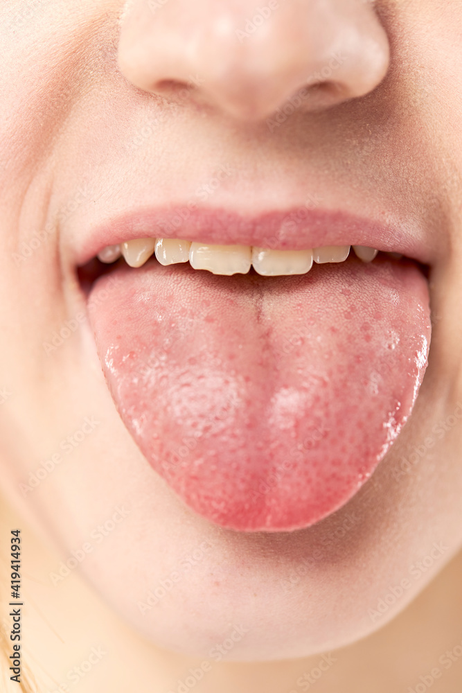 Fototapeta premium open mouth tongue lips of a young girl close up