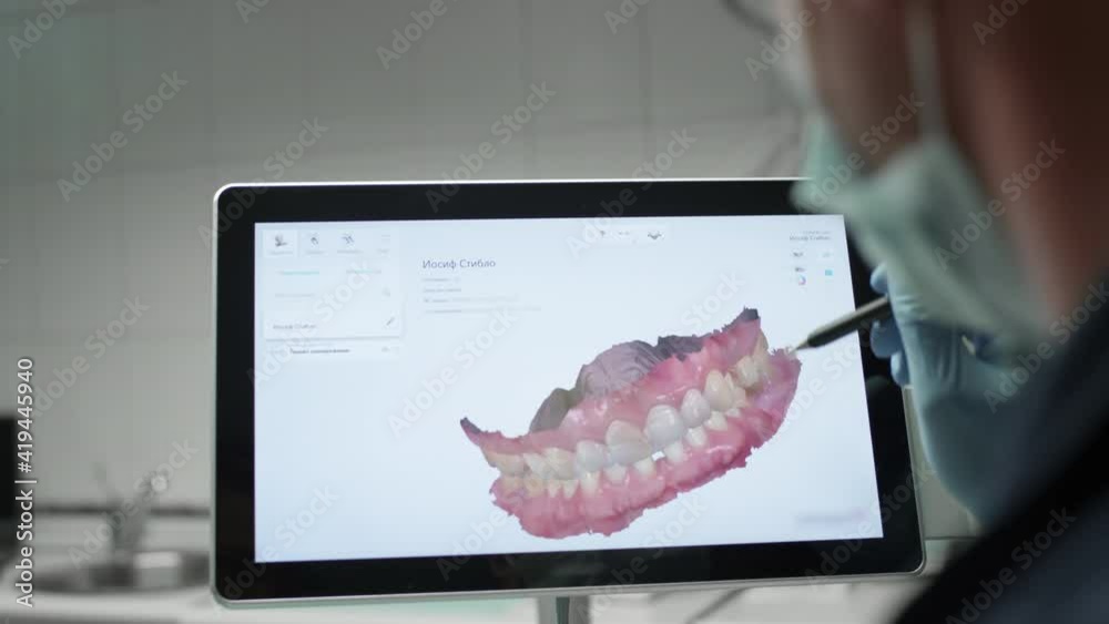 The doctor examines the 3D model of the jaw. A dentist examines a digital image of teeth on a monitor. Modern technologies in medicine and dentistry.
