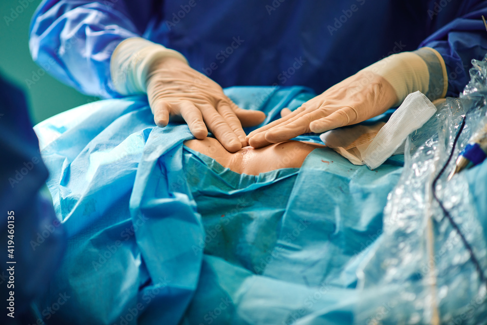Crop unrecognizable surgeon attaching adhesive bandage on postoperative