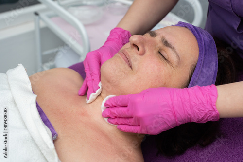 During the cosmetic procedure, the beautician wipes the skin on the face with cosmetic pads