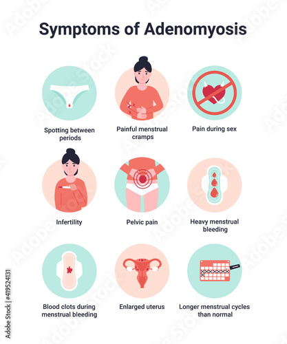 Set symptoms of adenomyosis, endometriosis interna or adenomyometritis. Flat vector cartoon modern illustration.