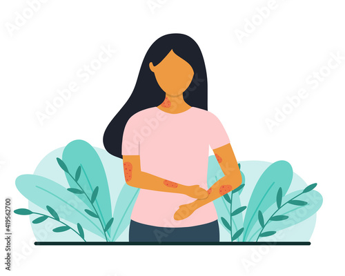Woman with skin problems. Psoriasis or eczema concept. Flat style vector illustration. photo