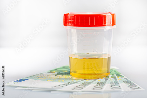 Labotatory container with human urine for medical test