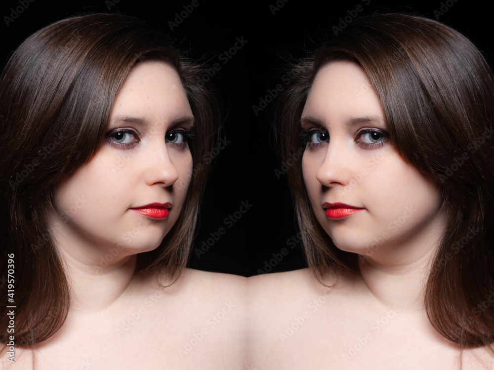 Woman moustache treatment concept. Mirror collage portrait of young woman before and after moustache removing. Woman moustache treatment concept. Mirror collage portrait of young woman before and after moustache removing.