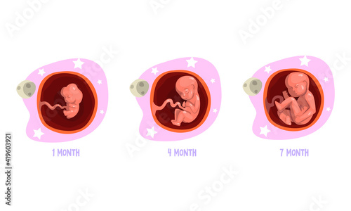 Stages of Embryo Development Set, 1, 4, 7 Month Cartoon Vector Illustration