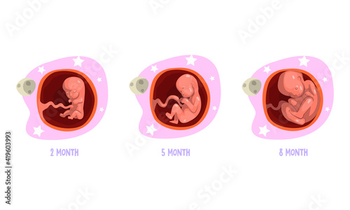 Stages of Embryo Development Set, 2, 5, 8 Month Cartoon Vector Illustration