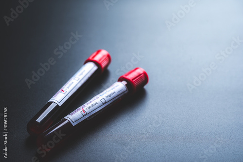 coronavirus COVID-19 human blood sample test in test tube, working for vaccine to protection of virus in laboratory