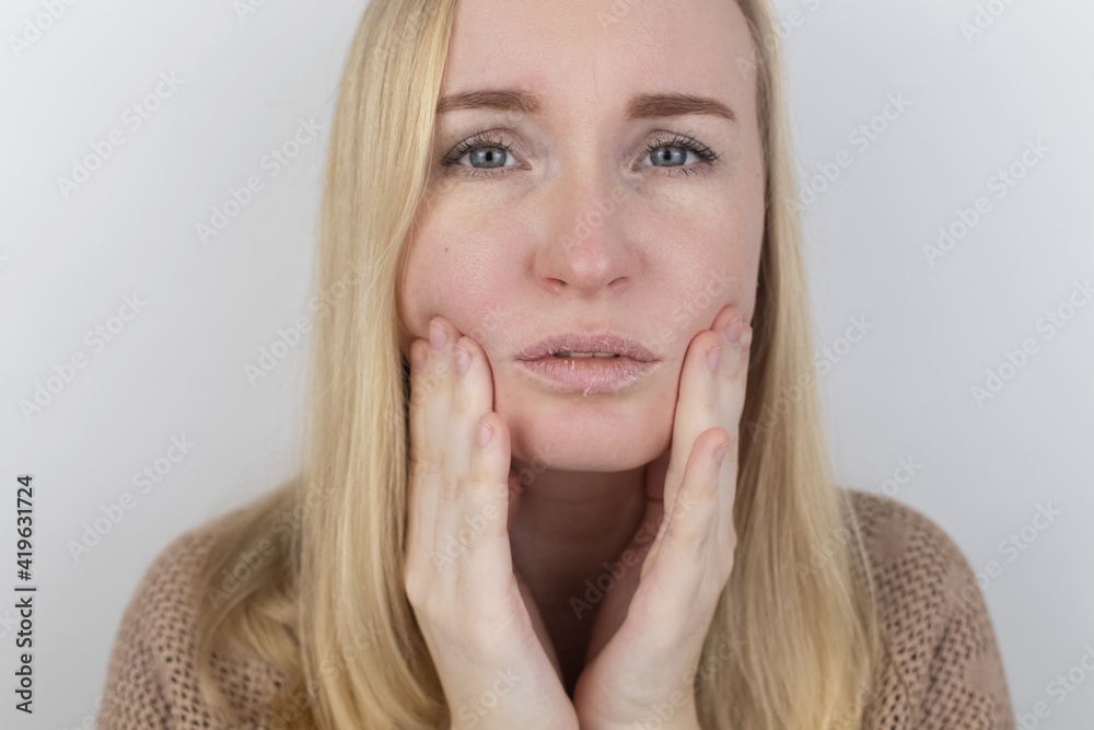 A woman examines dry skin on her lips. Peeling, coarsening, discomfort, skin sensitivity. Patient at the appointment of a dermatologist or cosmetologist. Close-up of pieces of dry skin A woman examines dry skin on her lips. Peeling, coarsening, discomfort, skin sensitivity. Patient at the appointment of a dermatologist or cosmetologist. Close-up of pieces of dry skin