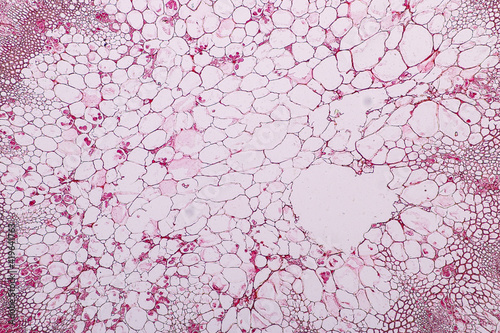 Characteristics of fungi living in wood as a group, are polyphyletic under the microscope for education. 