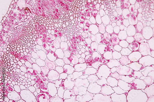 Characteristics of fungi living in wood as a group, are polyphyletic under the microscope for education. 