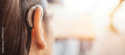 Deaf woman wearing hearing aid. Digital hearing aid in woman's ear. Brunette Woman with Modern Hearing Aid. Hearing Impaired. photo