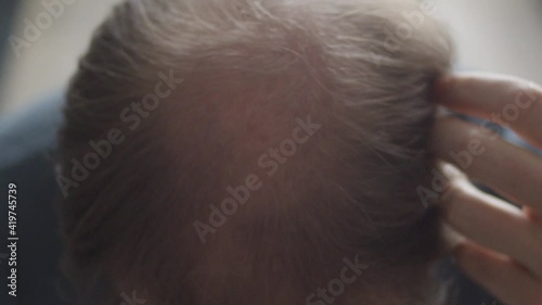 Man rubbing hand over his bald spot in his hair - front view photo